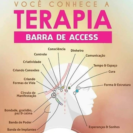 Barras de Access